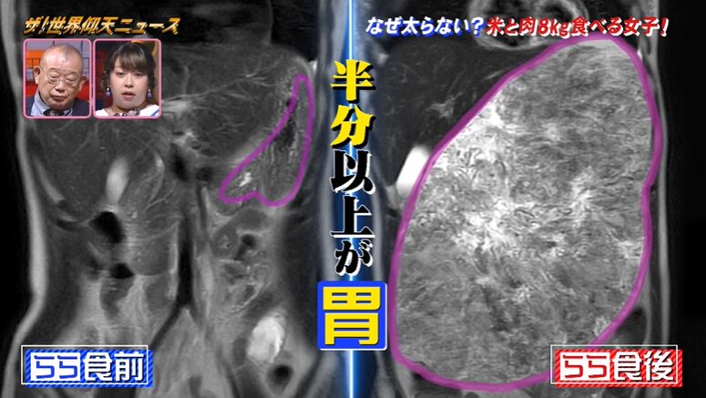 大食い後のららさんの胃の画像