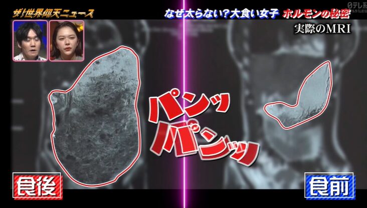 大食い女子の胃袋